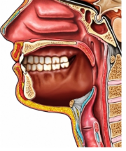 Mouth Cavity After Total Glossectomy