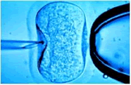 A microscopic image of a needle (left) injecting sperm cells directly into a human egg (center). The broad object at right is a pipette used to hold the ovum steady. (Phototake NYC. Reproduced by permission.)