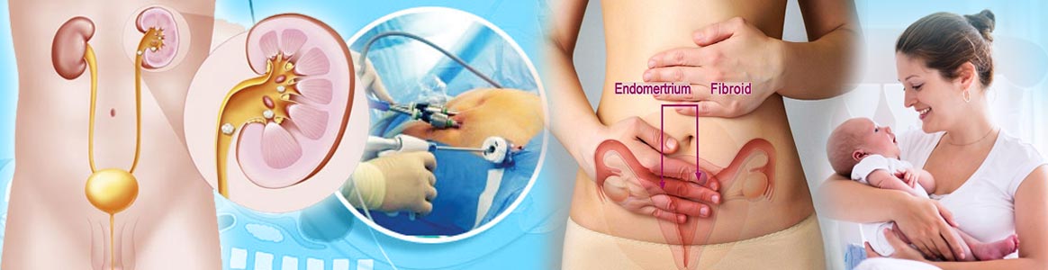 Laparoscopic Surgery India