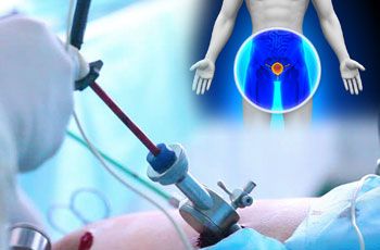 chirurgie urologique à faible coût meilleurs urologues meilleurs hôpitaux Kerala