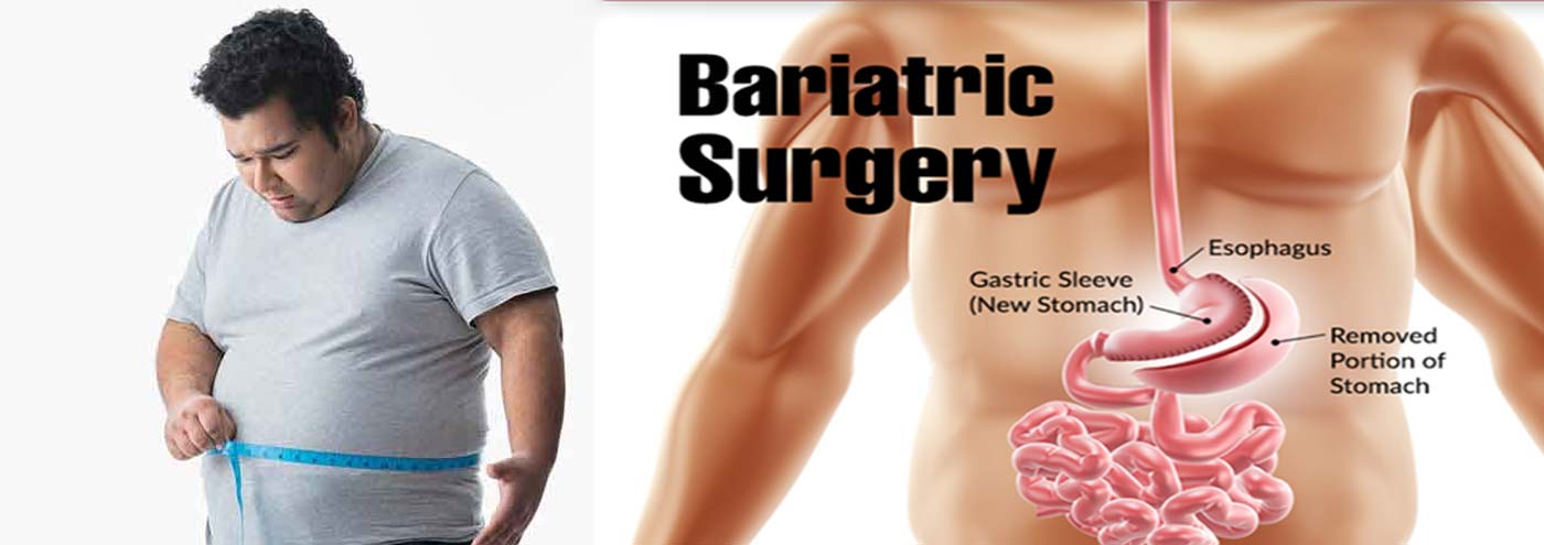 Bariatric Surgery